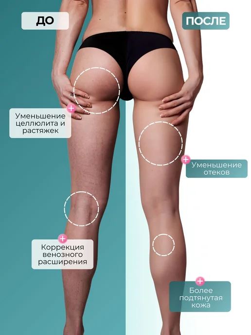 BBalance LYMPH Кинезио тейп для тела 5см*5м, бежевый, бежевый, фото 3