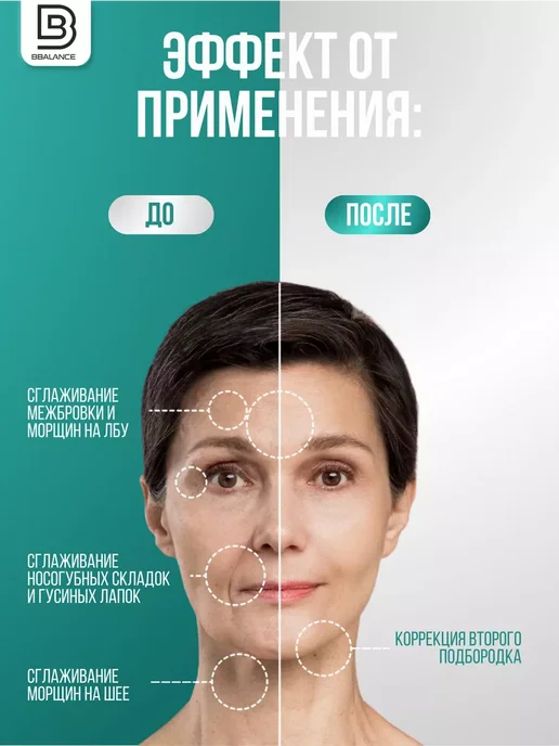 BBalance BASIC Кинезио тейп для тела 5см*5м, бежевый, бежевый, фото 5