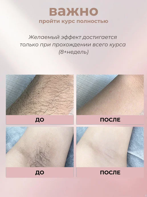 DELGADOJ&N Фотоэпилятор профессиональный лазерный для удаления волос, белый, фото 8