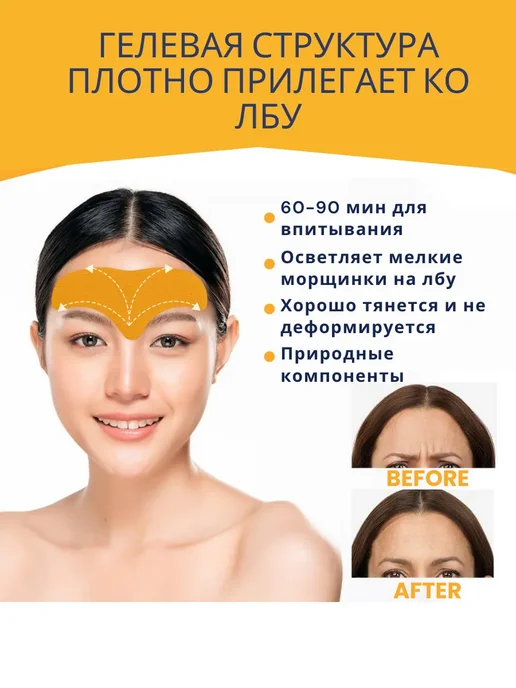 KateLove Тейпы для лба от морщин патчи антивозрастные, вариант, фото 2