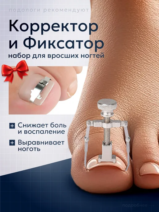 4opaShop корректор вросшего ногтя, серый