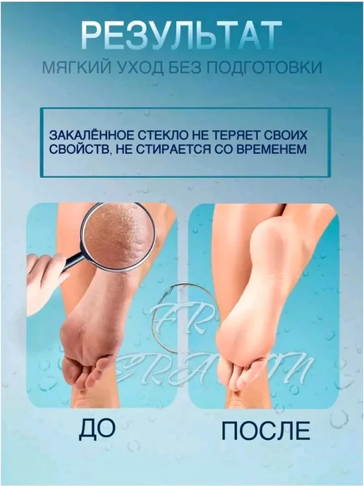 Азиз Пемза для ног и пяток пемза профессиональная нано терка 1шт, 1 шт, фото 6