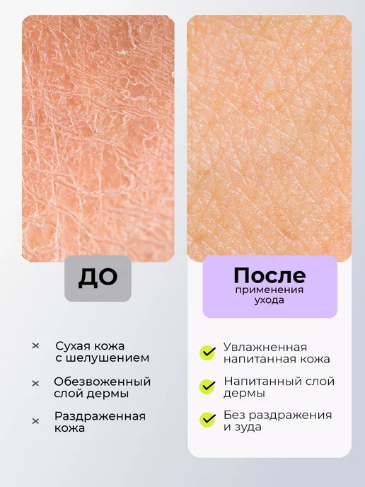RUNAIL Маска-перчатки для рук и ногтей питательная 1 пара, вариант, фото 2