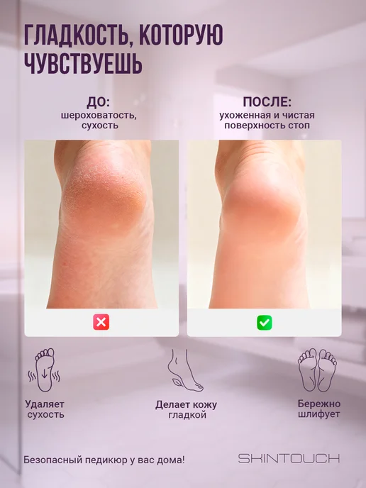 SKINTOUCH Электрическая пилка для пяток ног аппарат для смарт педикюра, фиолетовый, фото 6