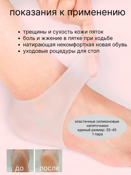 K.G.Fetter Силиконовые напяточники для педикюра, белый, фото 2