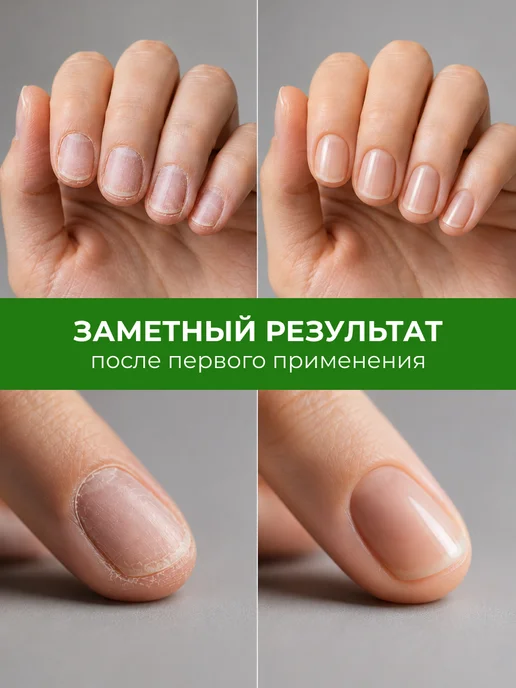 LUCKYLak Набор масло и ремувер для кутикулы Organic, вариант, фото 3