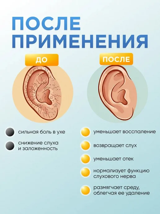 Прополис FORTE капли в уши и нос, 10 мл, 10 мл, фото 7