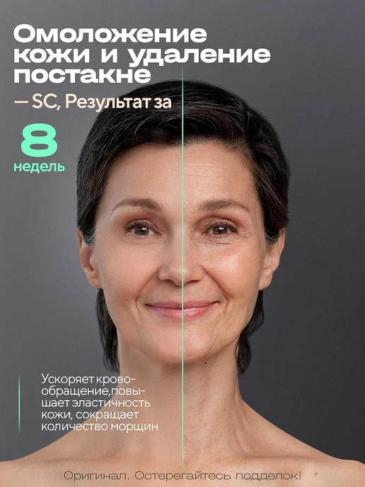 Gutsy Лазерный эпилятор профессиональный 3в1 мощный 22-24 Дж, белый, фото 6