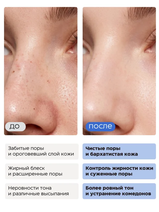 Medicube Пилинг пэды диски для лица с кислотами для сужения пор, 70 шт, фото 2