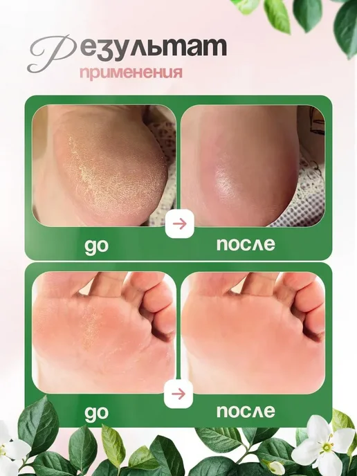 Ноги Тёрка для ног и пяток, белый, фото 4